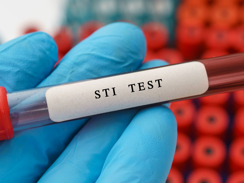 sti test800